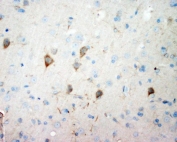 IHC testing of FFPE rat brain with NSE antibody. HIER: boil tissue sections in pH6, 10mM citrate buffer, for 20 min and allow to cool before testing.
