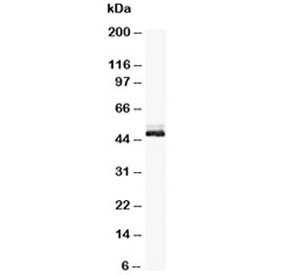 Western blot testing of NSE antibody and rat brain tissue lysate. Predicted molecular weight: ~47 kDa.~