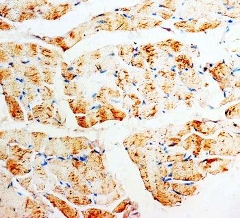 IHC-P: PMVK antibody testing of rat skeletal muscle tissue