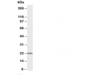 Western blot testing of PMVK antibody and rat heart tissue lysate