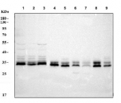 Western blot testing of 1) human HeLa, 2) human Caco-2, 3) human U-251, 4) rat brain, 5) rat PC-12, 6) mouse lung, 7) mouse liver, 8) mouse brain and 9) mouse NIH 3T3 cell lysate with PP2Ac antibody. Predicted molecular weight ~35 kDa.