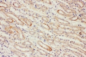 IHC staining of FFPE rat kidney with PP2Ac antibody. HIER: boil tissue sections in pH8 EDTA buffer for 20 min and allow to cool before testing.