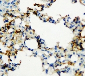 IHC-P: RAGE antibody testing of rat lung tissue