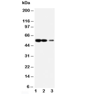Western blot testing of RAGE antibody and Lane 1: recombinant human protein 10ng; 2: 5ng; 3: 2.5ng~
