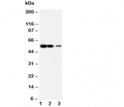 Western blot testing of RAGE antibody and Lane 1:  recombinant human protein 10ng;  2: 5ng;  3: 2.5ng