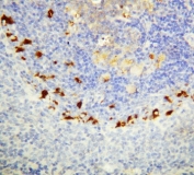 IHC-P: SOCS1 antibody testing of rat spleen tissue