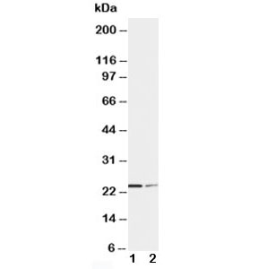 Western blot testing of SOCS1 antibody and Lane 1: HT1080; 2: COLO320 cell lysate. Predicted molecular weight ~ 24 kDa.~