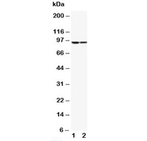Western blot testing of STAT1 antibody and human samples; Lane 1:  MCF-7; 2: HeLa. Predicted molecular weight: 84 and 91 kDa.~