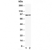 Western blot testing of STAT1 antibody and human samples; Lane 1: MCF-7;  2: HeLa lysate. Predicted molecular weight: ~91/84 kDa (alpha/beta).