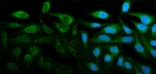 Immunofluorescent staining of FFPE human HeLa cells with STAT1 antibody (green) and DAPI nuclear stain (blue). HIER: steam section in pH6 citrate buffer for 20 min.