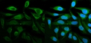 Western blot testing of STAT1 antibody and human samples; Lane 1: MCF-7;  2: HeLa lysate. Predicted molecular weight: ~91/84 kDa (alpha/beta).