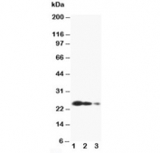 Western blot testing of TIMP3 antibody and Lane 1:  recombinant human protein 10ng;  2: 5ng;  3: 2.5ng