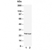 Western blot testing of TIMP4 antibody and Lane 1:  rat kidney;  2: human MCF-7;  Predicted/observed molecular weight: ~25 kDa.