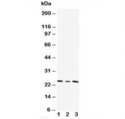 Western blot testing of TIMP4 antibody and Lane 1:  HT1080;  2: HeLa;  3: SMMC-7721 cell lysate. Predicted/observed molecular weight: ~25 kDa.