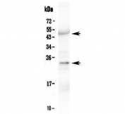 Western blot testing of human placenta lysate (50ug/lane) with VEGF antibody at 1ug/ml. Expected molecular weight 19~22 kDa (monomer) and 38~44 kDa (dimer). Banding may appear larger than predicted due to glycosylation.