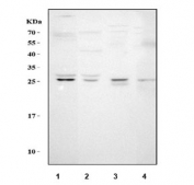 Western blot testing of human placenta lysate (50ug/lane) with VEGF antibody at 1ug/ml. Expected molecular weight 19~22 kDa (monomer) and 38~44 kDa (dimer). Banding may appear larger than predicted due to glycosylation.