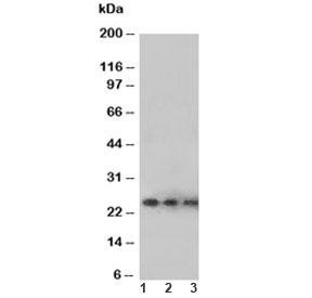 Western blot testing of VEGF antibody and Lane 1: Recombinant human protein 10ng; 2: 5ng; 3: 2.5ng~