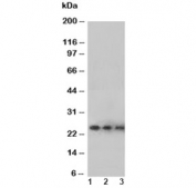 Western blot testing of VEGF antibody and Lane 1:  Recombinant human protein 10ng;  2: 5ng;  3: 2.5ng