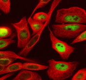 Immunofluorescent staining of FFPE human SiHa cells with SKP2 antibody (green) and Alpha Tubulin mAb (red). HIER: steam section in pH6 citrate buffer for 20 min.