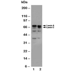 Western blot testing of Lamin A/C antibody and Lane 1: HeLa; 2: A431 cell lysate