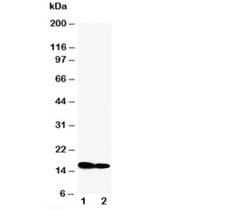 Western blot testing of IFITM1 antibody and Lane 1: SW620; 2: CEM cell lysate~