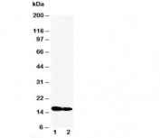 Western blot testing of IFITM1 antibody and Lane 1:  SW620;  2: CEM cell lysate