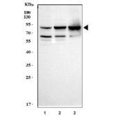 Western blot testing of human 1) 293T, 2) MCF7 and 3) T47D cell lysate with Gamma Catenin antibody. Expected molecular weight: ~86 kDa. 