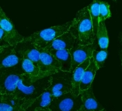 Immunofluorescent staining of FFPE human HeLa cells with Gamma Catenin antibody (green) and DAPI nuclear stain (blue). HIER: steam section in pH6 citrate buffer for 20 min.
