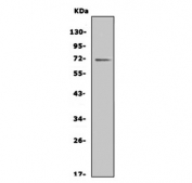 Western blot testing of MMP16 antibody and human heart tissue lysate. Predicted molecular weight: ~70 kDa (long form), ~53 kDa (short form).