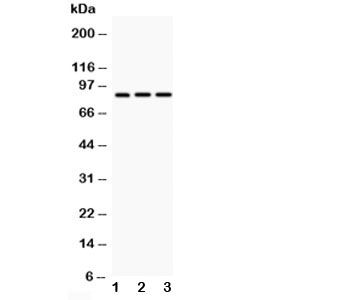 Western blot testing of CD18 antibody and Lane 1: HeLa; 2: Jurkat; 3: HT1080; Predicted/Observed size: 85~95KD depending on glycosylation level~