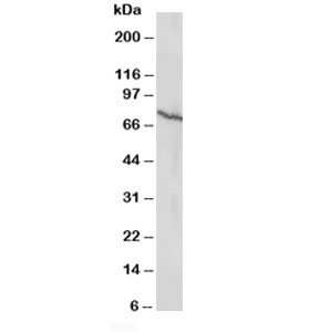 Western blot testing of Estrogen receptor antibody and MCF-7 lysate (human breast cancer line). Predicted/expected size ~67KD