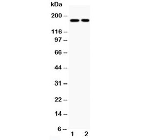 Western blot testing of Topoisomerase II alpha antibody and Lane 1: HeLa; 2: Jurkat; Predicted size: 174KD; Observed size: 174KD