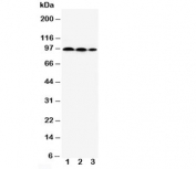 Western blot testing of HIF2a antibody and Lane 1:  HeLa;  2: MCF-7;  3: Jurkat cell lysate