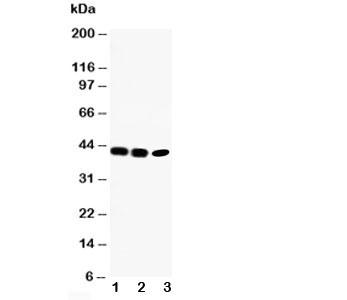 Western blot testing of CCR6 antibody and Lane 1: rat liver; 2: SW620; 3: CEM cell lysate