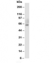 Western blot testing of Chk2 antibody and MCF-7 cell lysate. Expected molecular weight: ~61kDa.