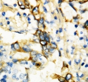IHC-P: TNFR1 antibody testing of human breast tissue