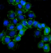 Immunofluorescent staining of FFPE human A431 cells with beta Catenin antibody (green) and DAPI nuclear stain (blue). HIER: steam section in pH6 citrate buffer for 20 min.