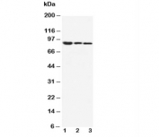Western blot testing of beta Catenin antibody and Lane 1:  MM453;  2: MCF-7;  3: HeLa cell lysate. Predicted molecular weight ~85 kDa, but routinely observed at 90-95 kDa.