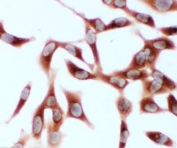 ICC testing of HSC70 antibody and human HeLa cells. HIER: boil tissue sections in pH6, 10mM citrate buffer, for 20 min and allow to cool before testing.