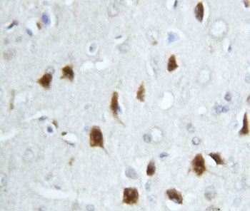 IHC-P testing of rat brain tissue with HSC70 antibody. HIER: boil tissue sections in pH6, 10mM citrate buffer, for 20 min and allow to cool before testing.