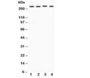 Western blot testing of NOTCH1 antibody and Lane 1:  MCF-7;  2: HeLa;  3: Jurkat;  4: COLO320. Predicted molecular weight: ~ 270 kDa (full length), ~ 120 kDa (transmembrane fragment).