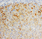 IHC-P: FGF8 antibody testing of rat ovary tissue. HIER: steamed with pH6 citrate buffer.