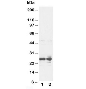 Western blot testing of FGF8 antibody and rat ovary tissue lysate~