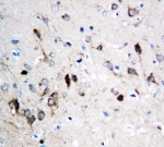 IHC testing of FFPE rat brain tissue with NMDAR1 antibody. Required HIER: steam section in pH6 citrate buffer for 20 min and allow to cool prior to staining.
