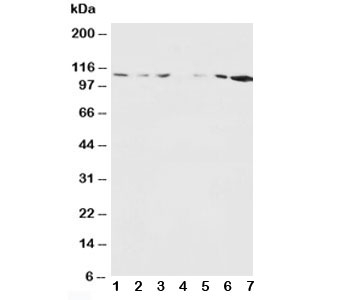 Western blot testing of NMDAR1 antibody and Lane 1: rat brain; 2: rat brain; 3: rat liver; 4: rat heart; 5: MM453; 6: MM231; 7: HeLa cell lysate~