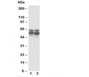 Western blot testing of RUNX2 antibody and Lane 1:  rat thymus;  2: rat testis tissue lysate. Predicted molecular weight: 50-60 kDa.