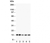 Western blot testing of FABP1 antibody and Lane 1:  rat liver;  2: rat kidney;  3: HeLa;  4: (mouse) Neuro-2a;  5: (human) SMMC-7721 cell lysate. Predicted molecular weight: ~14 kDa.