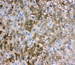 IHC-P: FABP1 antibody testing of rat liver tissue. HIER: steamed with pH6 citrate buffer.