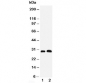 Western blot testing of Aquaporin 5 antibody and Lane 1:  rat lung;  2: rat testis tissue lysate. Predicted molecular weight ~28 kDa.