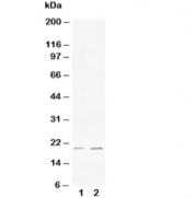 Western blot testing of 1) human HeLa and 2) rat PC-12 cell lysate with Bcl-XS antibody. Predicted/observed molecular weight: ~19 kDa.